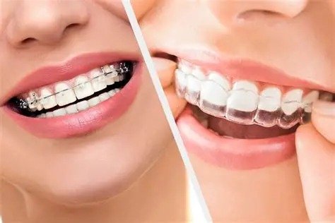 Orthodontics
